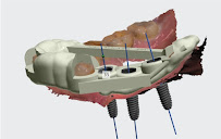 Cosmetic Dentistry Vietnam Hung
