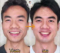 Nha sĩ Đặng Viết Khánh