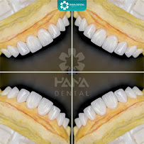 Nha khoa Thẩm Mỹ Quốc Tế HaNa