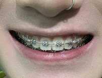 Nha Khoa Quốc Tế Maxdental
