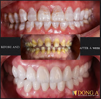 Đông Á Esthetics Dental Lab