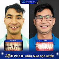 Nha Khoa Lucci