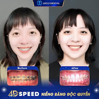 Nha Khoa Lucci
