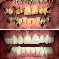 Nha Khoa Việt Đức - nha khoa uy tín giá hợp lý, gần nhất tại Mỹ Đình Hà Nội