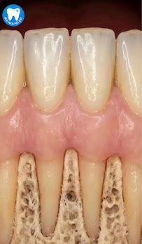 Nha Khoa Việt Đức - nha khoa uy tín giá hợp lý, gần nhất tại Mỹ Đình Hà Nội