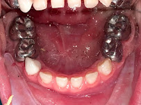 Nha Khoa Ngọc Liên - 14 Nguyễn Đổng Chi