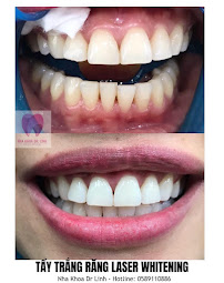 Nha khoa Dr.Linh Dental Care & Beauty Đà Nẵng