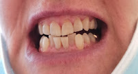 VINDENTIST