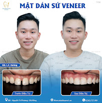 Nha khoa No1 Đà Nẵng - Nha Khoa Thẩm Mỹ - Chỉnh Nha