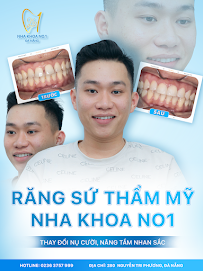 Nha khoa No1 Đà Nẵng - Nha Khoa Thẩm Mỹ - Chỉnh Nha