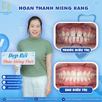 Nha khoa No1 Đà Nẵng - Nha Khoa Thẩm Mỹ - Chỉnh Nha