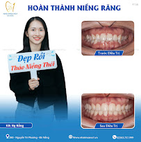 Nha khoa No1 Đà Nẵng - Nha Khoa Thẩm Mỹ - Chỉnh Nha