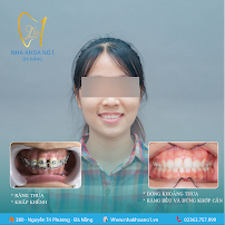 Nha khoa No1 Đà Nẵng - Nha Khoa Thẩm Mỹ - Chỉnh Nha