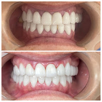 Nha Khoa Tài Smile
