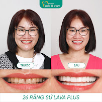 Nha khoa Quốc Tế Happy Đà Nẵng - Răng Sứ, Tẩy Trắng Răng, Trám Răng, Cạo Vôi Răng