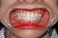 Nha khoa Smile Tam Kỳ