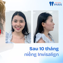 Nha Khoa Paris Đà Nẵng