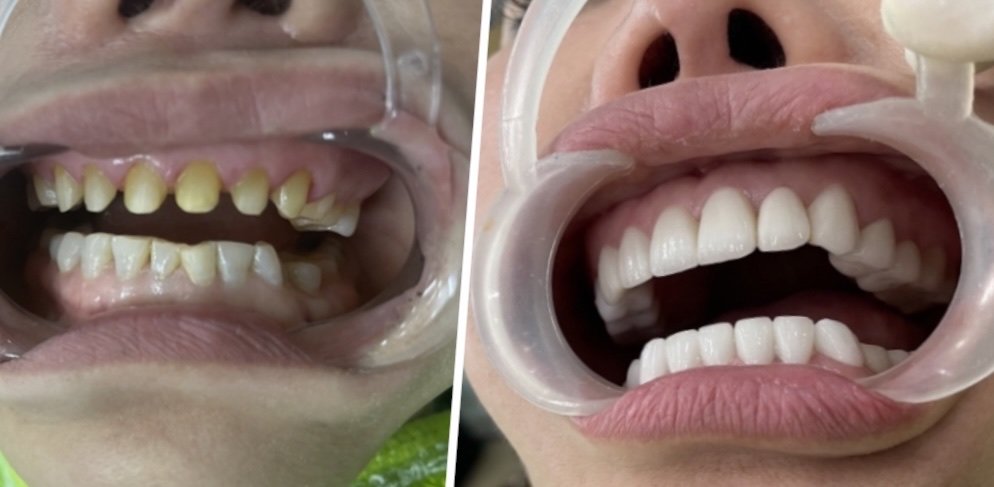 Phong Rang Tham My Bac Sy Luyen dental clinic