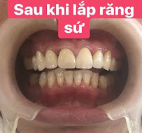 Nha Khoa Nam Anh