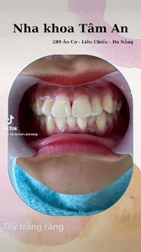 NHA KHOA TÂM AN 167 Âu Cơ
