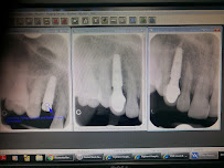Dentalis Implant Center by Vejthani