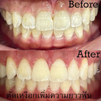 Mister Dentist Silom คลินิกทันตกรรมมิสเตอร์เดนทิส สาขาสีลม