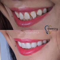 Deezy dental home บางรัก | ทำฟัน จัดฟัน วีเนียร์ รากฟันเทียม