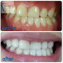 Deezy dental home บางรัก | ทำฟัน จัดฟัน วีเนียร์ รากฟันเทียม