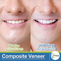 Deezy dental home บางรัก | ทำฟัน จัดฟัน วีเนียร์ รากฟันเทียม