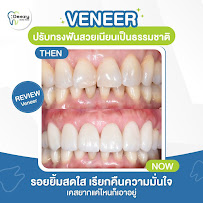 Deezy dental home บางรัก | ทำฟัน จัดฟัน วีเนียร์ รากฟันเทียม