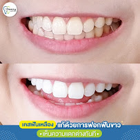 Deezy dental home บางรัก | ทำฟัน จัดฟัน วีเนียร์ รากฟันเทียม