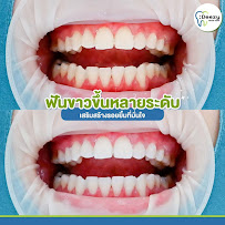 Deezy dental home บางรัก | ทำฟัน จัดฟัน วีเนียร์ รากฟันเทียม