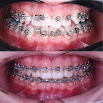 SDC1st Dentist (ศาลาแดง ซ.1 ทันตกรรม)