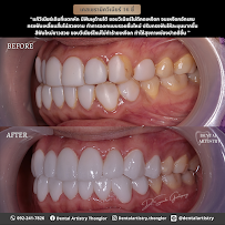 Dental Artistry Thonglor คลินิกทันตกรรมเดนทัลอาร์ทิสทรีทองหล่อ