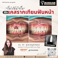 คลินิกทันตกรรม เดอะ ทูธ คลับ The Tooth Club