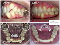 Siamdent Dental Clinic สาขาพหลโยธิน