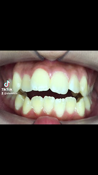 Siamdent Dental Clinic สาขาพหลโยธิน