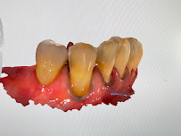 บางเเก้วสไมล์ คลินิกทันตกรรม bangkaew smile รักษาราก ทำรากเทียม ครอบฟัน วีเนียร์ Bangkaew Smile Dental Clinic