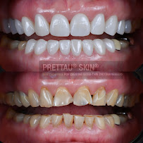บางเเก้วสไมล์ คลินิกทันตกรรม bangkaew smile รักษาราก ทำรากเทียม ครอบฟัน วีเนียร์ Bangkaew Smile Dental Clinic