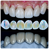 บางเเก้วสไมล์ คลินิกทันตกรรม bangkaew smile รักษาราก ทำรากเทียม ครอบฟัน วีเนียร์ Bangkaew Smile Dental Clinic