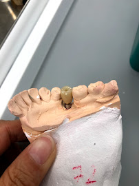 บางเเก้วสไมล์ คลินิกทันตกรรม bangkaew smile รักษาราก ทำรากเทียม ครอบฟัน วีเนียร์ Bangkaew Smile Dental Clinic