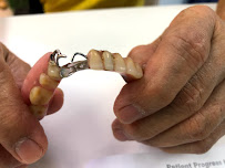 บางเเก้วสไมล์ คลินิกทันตกรรม bangkaew smile รักษาราก ทำรากเทียม ครอบฟัน วีเนียร์ Bangkaew Smile Dental Clinic