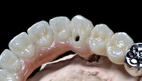 บางเเก้วสไมล์ คลินิกทันตกรรม bangkaew smile รักษาราก ทำรากเทียม ครอบฟัน วีเนียร์ Bangkaew Smile Dental Clinic
