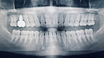 บางเเก้วสไมล์ คลินิกทันตกรรม bangkaew smile รักษาราก ทำรากเทียม ครอบฟัน วีเนียร์ Bangkaew Smile Dental Clinic