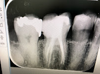 บางเเก้วสไมล์ คลินิกทันตกรรม bangkaew smile รักษาราก ทำรากเทียม ครอบฟัน วีเนียร์ Bangkaew Smile Dental Clinic