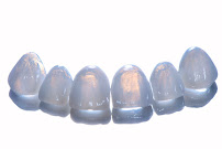 บางเเก้วสไมล์ คลินิกทันตกรรม bangkaew smile รักษาราก ทำรากเทียม ครอบฟัน วีเนียร์ Bangkaew Smile Dental Clinic