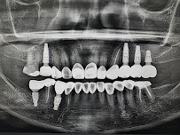 The Glass Smile Dental Clinic เดอะกลาสสไมล์ รากเทียม วีเนียร์ รักษาราก ครอบฟัน