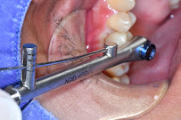 The Glass Smile Dental Clinic เดอะกลาสสไมล์ รากเทียม วีเนียร์ รักษาราก ครอบฟัน