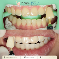 Bros Dental Clinic