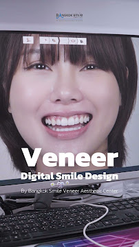 Smile Express Dental Clinic in Bangkok